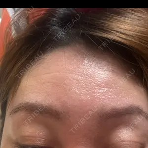 TCB東京中央美容外科 神戸院口コミ