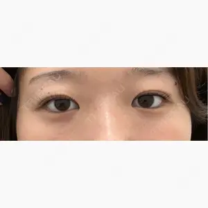 TCB東京中央美容外科 梅田大阪駅前院口コミ