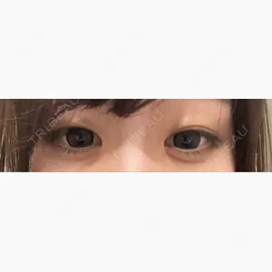 広島プルミエクリニック口コミ