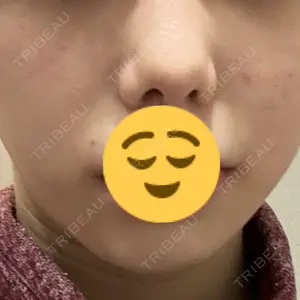 Nクリニック伏見口コミ