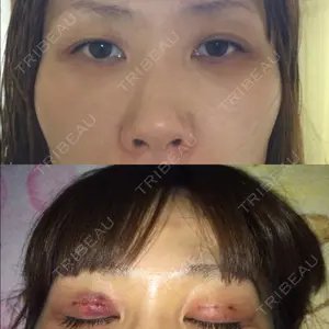 品川美容外科 札幌院口コミ