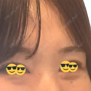 HAAB×DREAM BEAUTY CLINIC 東京本院口コミ