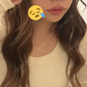 HAAB×DREAM BEAUTY CLINIC 東京本院口コミ