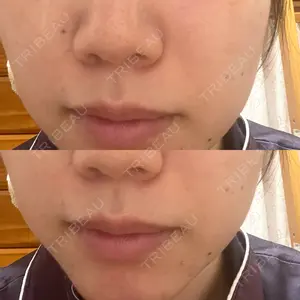 ルラ美容クリニック 千葉院 / ルラスキンクリニック 千葉院口コミ