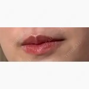 ルラ美容クリニック 新宿院口コミ