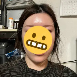 TCB東京中央美容外科 越谷院口コミ