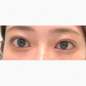 フィラークリニック 新宿院口コミ