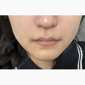 ライブリークリニック 大阪院口コミ