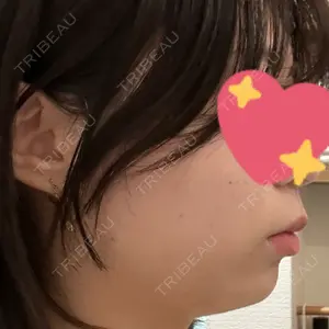 東京美容外科 福山院口コミ