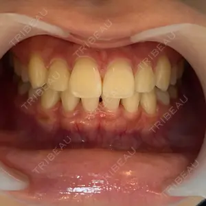 ビジューデンタルサロン口コミ