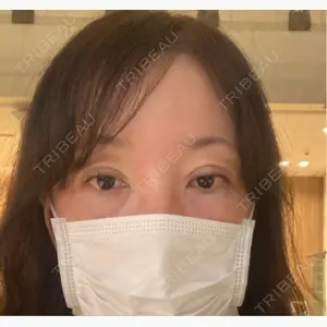 NARU Beauty Clinic 【ナルクリ】口コミ