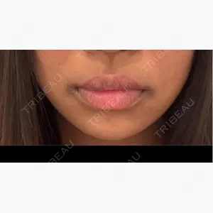 Wi Clinic（ウィ クリニック） 吉祥寺院口コミ