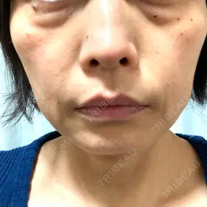 ハナビューティークリニック口コミ