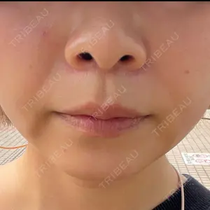 HAAB BEAUTY CLINIC 南青山本院（新院）口コミ