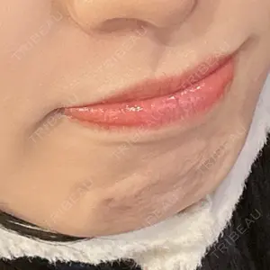 ルラ美容クリニック 仙台院 / ルラスキンクリニック 仙台院口コミ