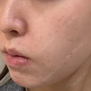 BIANCA銀座口コミ
