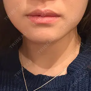 TCB東京中央美容外科 名古屋栄院口コミ