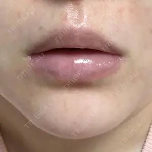 Tokyo Tensei Clinic 新宿院口コミ