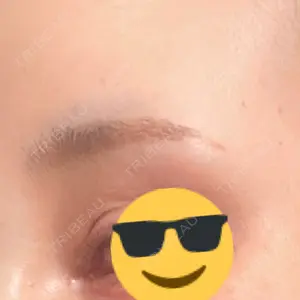 APOLLO BEAUTY CLINIC口コミ