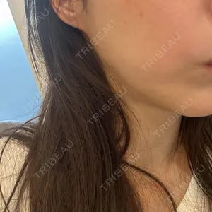 ルラ美容クリニック 千葉院 / ルラスキンクリニック 千葉院口コミ