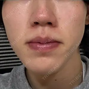 APスキンクリニック銀座口コミ