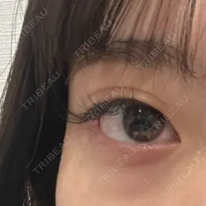 R Beauty CLINIC 大阪院口コミ