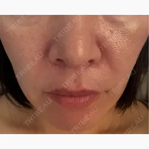 NARU Beauty Clinic 【ナルクリ】 水戸院口コミ