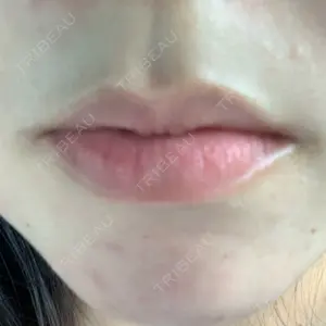 ルラ美容クリニック 大阪心斎橋院口コミ