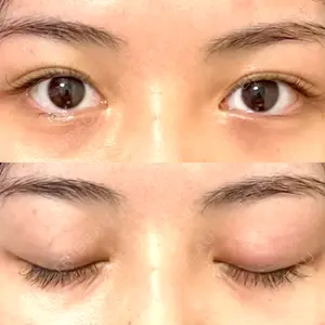 湘南美容クリニック 池袋東口院口コミ