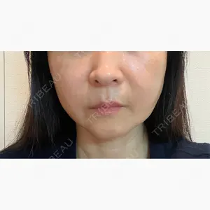 スマートスキンクリニック 神保町院口コミ