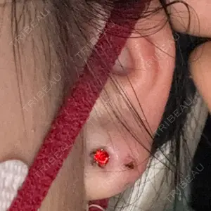 新宿ラクル美容外科クリニック 六本木院口コミ