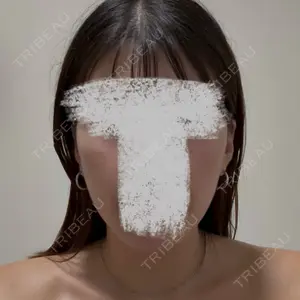 セギム美容整形外科口コミ