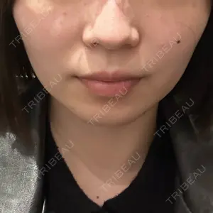 PRO CLINIC プロクリニック 銀座院口コミ