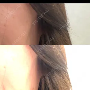 MIO CLINIC 梅田院口コミ