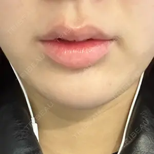 AZ BEAUTY CLINIC口コミ