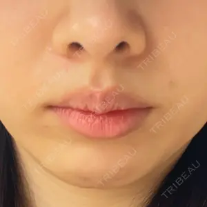 AYANAフィラーズクリニック 武蔵小杉院口コミ