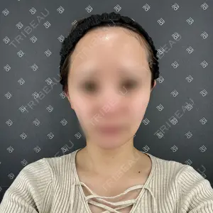 EMMO FACE CLINIC 東京三田院口コミ