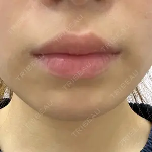 ルラ美容クリニック 大阪本院口コミ