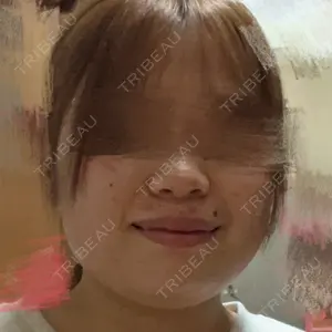 東京シルククリニック 新宿院口コミ