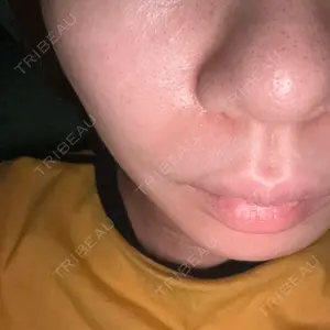 エトワールレジーナクリニック新宿院口コミ