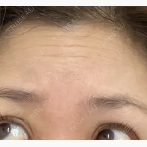 TCB東京中央美容外科 北千住院口コミ