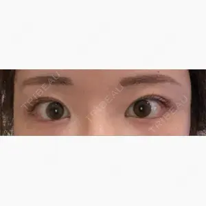 R Beauty CLINIC 銀座院口コミ