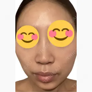 美容皮膚科エルムクリニック 麻布院口コミ