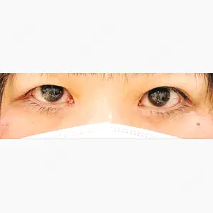 吉祥寺アイビークリニック口コミ