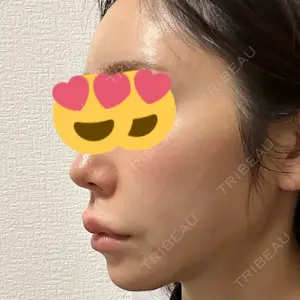 HAAB×DREAM BEAUTY CLINIC 大阪梅田院口コミ