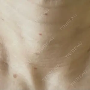 ゆきスキンクリニック 東池袋口コミ