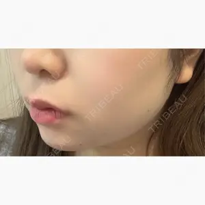 HAAB BEAUTY CLINIC 南青山本院（新院）口コミ