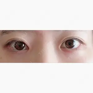 新宿美容外科ネビュラクリニック口コミ