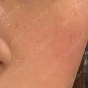 東京素肌クリニック 新宿院口コミ