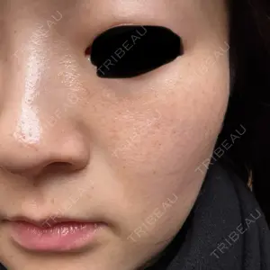 Chloe Cheongdam Clinic （クロエチョンダムクリニック）口コミ